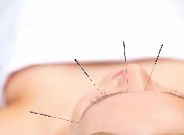 Acupuncture at Sea on Celebrity Summit